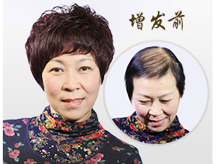 女士补发方案